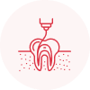 Root Canal Treatment