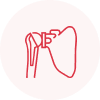 Shoulder Replacement